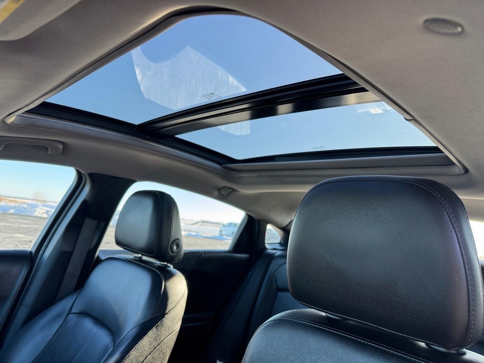 2017 Chevrolet Malibu LT